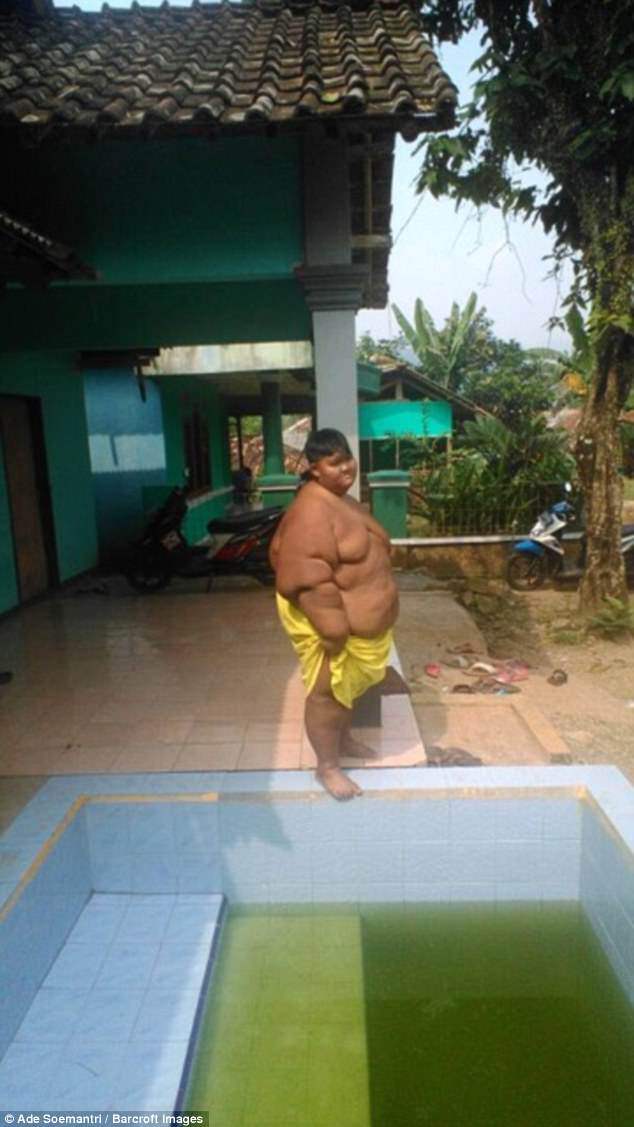 Bé trai 10 tuổi nặng 190kg vì ăn 5 bữa mỗi ngày với gà rán, cơm, mì và kem - 6