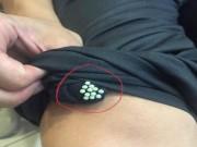 Nhà đẹp - Thấy những hạt li ti này dính trên quần áo thì tuyệt đối cẩn thận kẻo bị bệnh nguy hiểm