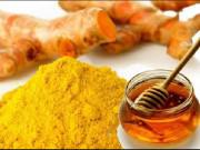 Sức khỏe - Có nên uống mật ong, nghệ lâu dài?