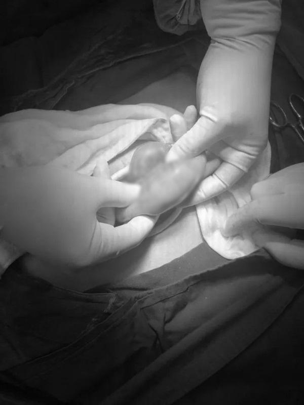 Ăn lựu mỗi ngày, người phụ nữ trẻ khiến bác sĩ giật mình khi thấy thứ nằm trong bụng - 1