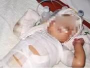 Làm mẹ - Ăn nòng nọc, uống nước bạc - những cách chữa bệnh phản khoa học khiến trẻ "thập tử nhất sinh"