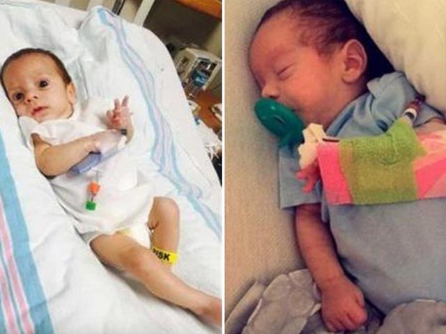 Sau sinh, bố mẹ bàng hoàng phát hiện con từng đột quỵ trong tử cung