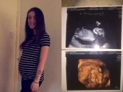 Tin thế giới - Nỗi đau của người mẹ chưa sinh con đã phải nghĩ đến chuyện tổ chức đám tang cho con