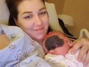 Nuôi con - Cô bé sơ sinh có vết bớt trên mặt nhưng cha mẹ nhất quyết không phẫu thuật