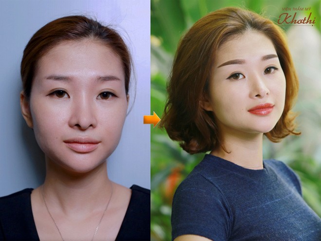 Ngày của Mẹ 13/5, hãy đưa mẹ đi làm đẹp vì lý do sau - 3