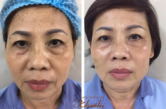 Ngày của Mẹ 13/5, hãy đưa mẹ đi làm đẹp vì lý do sau - 2