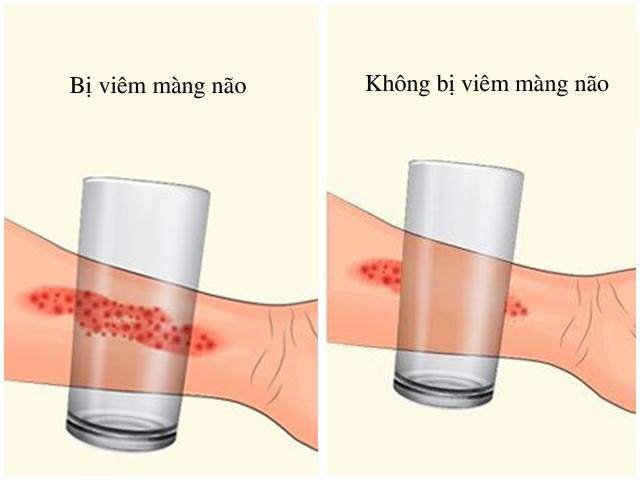 Ngày hè nóng nực, thấy trẻ có những biểu hiện này cần gặp bác sĩ ngay kẻo muộn