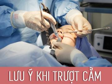 Trượt cằm vốn phức tạp và có rủi ro biến chứng cao, vậy chị em cần lưu ý điều gì?