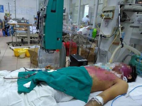 Tự ý mua thuốc điều trị thủy đậu tại nhà, 2 người chết, 1 người nguy kịch