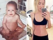 Bà bầu - Sau hơn 20 năm, nữ người mẫu sốc nặng khi biết được bí ẩn về "vết bớt" của mình