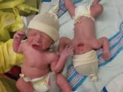 Làm mẹ - Phản ứng kì lạ của cặp song sinh khi bị tách nhau khiến 5 triệu người xem không ngừng