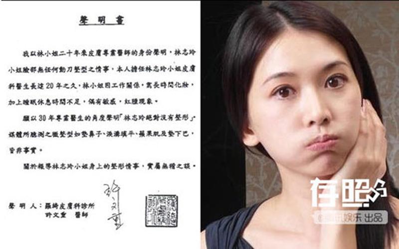 Không riêng Hồ Ngọc Hà, nhiều người đẹp cũng đập tan tin đồn sửa mũi bằng cách này - 15