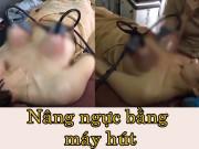 Làm đẹp - Tám chuyện dao kéo: nâng ngực bằng máy hút không mổ xẻ, hiệu quả tức thì?