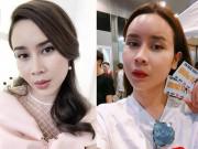 Làm đẹp - Nhờ đâu độn trán lại trở thành cơn sốt trong cộng đồng làm đẹp và giới nghệ sĩ châu Á?