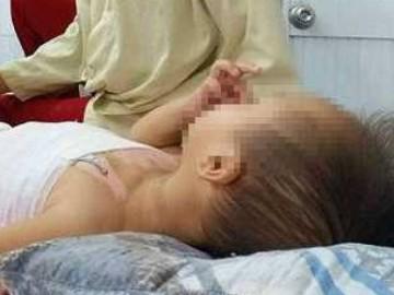 Bôi tinh dầu tràm giữ ấm cho con 6 tháng tuổi, mẹ tá hỏa khi thấy ngực bé phồng rộp