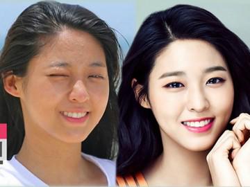 Lạm dụng phấn, nhiều sao Hàn đau đầu vì mặt chi chít mụn