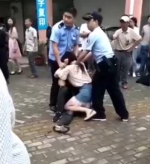 Thể hiện tình cảm mãnh liệt, cô gái cắn đứt lưỡi bạn trai - 1