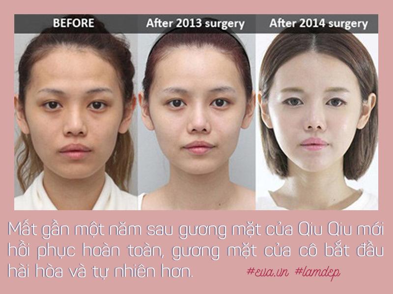 Năm 2014: cô tiếp tục tu sửa lại một số bộ phận trên khuôn mặt mình.

