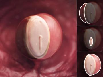 Thai nhi 4 tuần tuổi: Bé lớn bằng hạt vừng