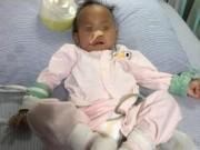 Sức khỏe - Bé 13 tháng tuổi "bục" dạ dày vì mẹ cho ăn ngô: 5 người "cấm" ăn không chỉ trẻ nhỏ