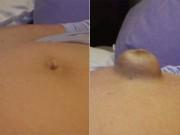 Bà bầu - Chồng thích thú đăng clip "rốn thần kỳ" của vợ bầu, không ngờ dân mạng cảnh báo "Đi khám ngay!"