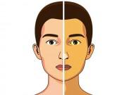 Sức khỏe - Những dấu hiệu tưởng là bệnh nan y nhưng thực chất là do thiếu vitamin B12