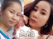 Đẹp - Nâng chân mày cải thiện nếp nhăn và mí sụp nhưng không chỉ dành cho phụ nữ trung niên!