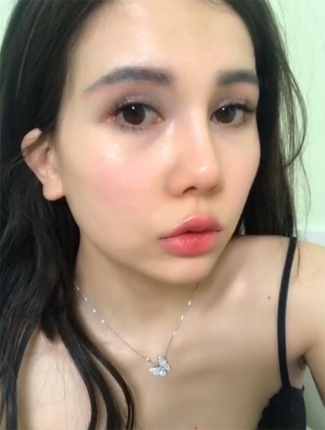 Nâng chân mày cải thiện nếp nhăn và mí sụp nhưng không chỉ dành cho phụ nữ trung niên! - 4