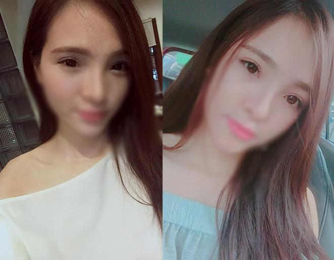 Nâng chân mày cải thiện nếp nhăn và mí sụp nhưng không chỉ dành cho phụ nữ trung niên! - 12