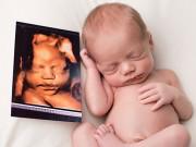 Bà bầu - Đi siêu âm 4D đều đặn nhưng không phải mẹ bầu đã biết tất cả những điều này!