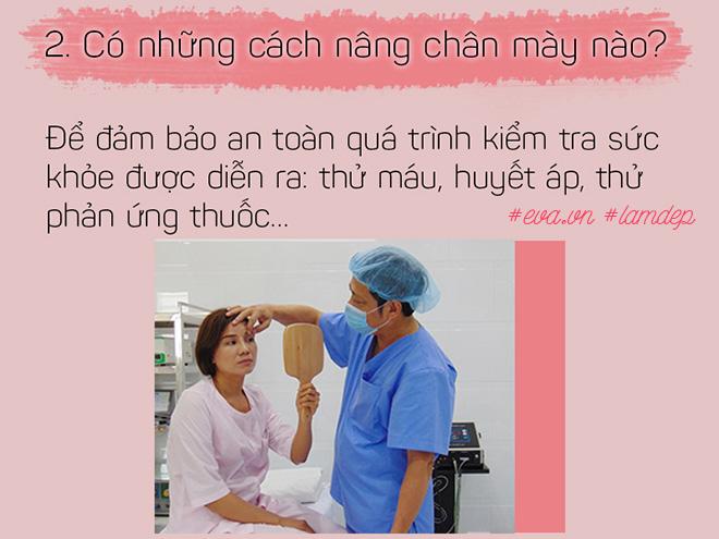 Bỏ 20 triệu chữa sụp mí bằng nâng cung chân mày, chị em nhận được gì? - 2