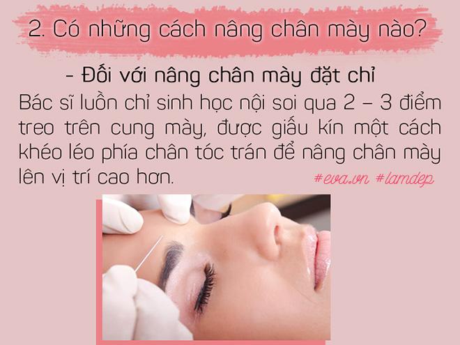 Bỏ 20 triệu chữa sụp mí bằng nâng cung chân mày, chị em nhận được gì? - 3