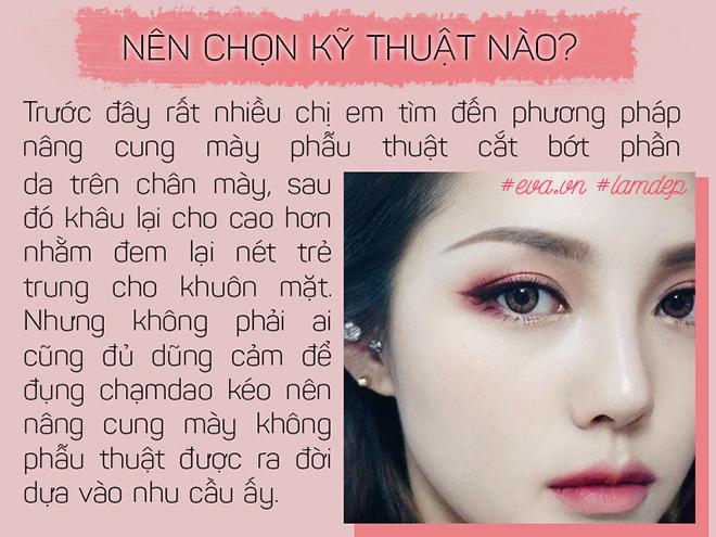 Bỏ 20 triệu chữa sụp mí bằng nâng cung chân mày, chị em nhận được gì? - 5