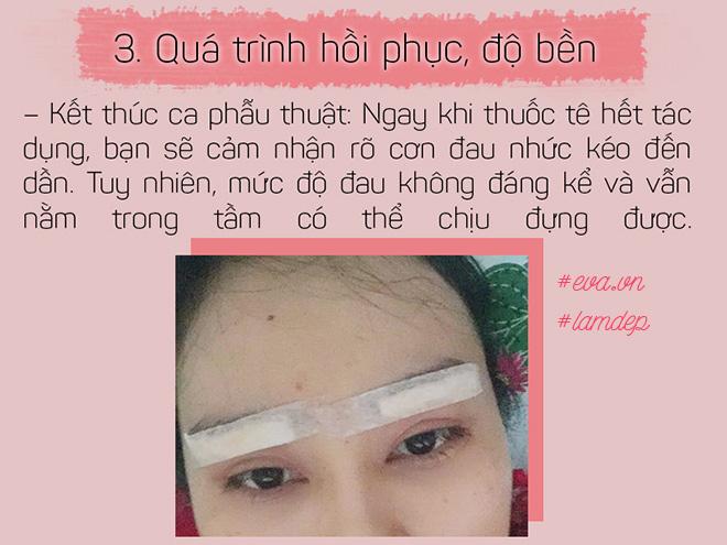 Bỏ 20 triệu chữa sụp mí bằng nâng cung chân mày, chị em nhận được gì? - 6