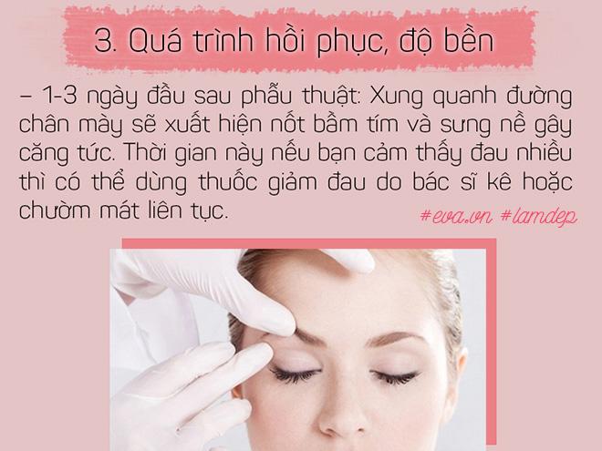 Bỏ 20 triệu chữa sụp mí bằng nâng cung chân mày, chị em nhận được gì? - 7