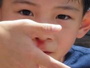 Sức khỏe - Thấy con chảy máu cam, mẹ trẻ liền làm điều này nhưng ngay sau đó hối hận tột cùng
