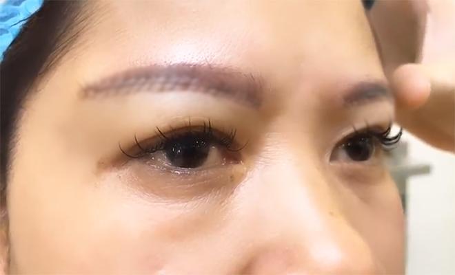 Nâng chân mày xong, các nàng cần lưu ý những điều gì? - 1