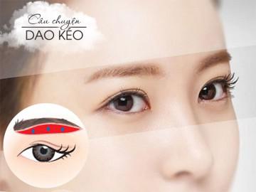 Nâng chân mày xong, các nàng cần lưu ý những điều gì?