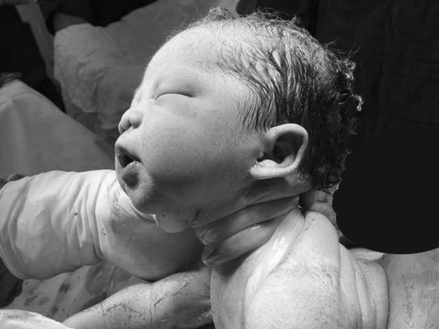 Bé Sài Gòn chào đời với dây rốn quấn chặt cổ: Các mẹ hốt hoảng, bác sĩ bảo chuyện thường