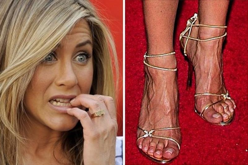 Jennifer Aniston cũng bị soi đôi chân đáng sợ khi liên tục gồng mình trên giày cao.
