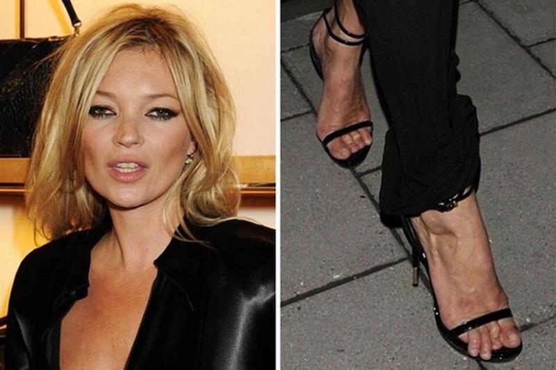 Kate Moss vốn được ca ngợi là hoàn hảo nhưng cũng có đôi chân mất điểm.
