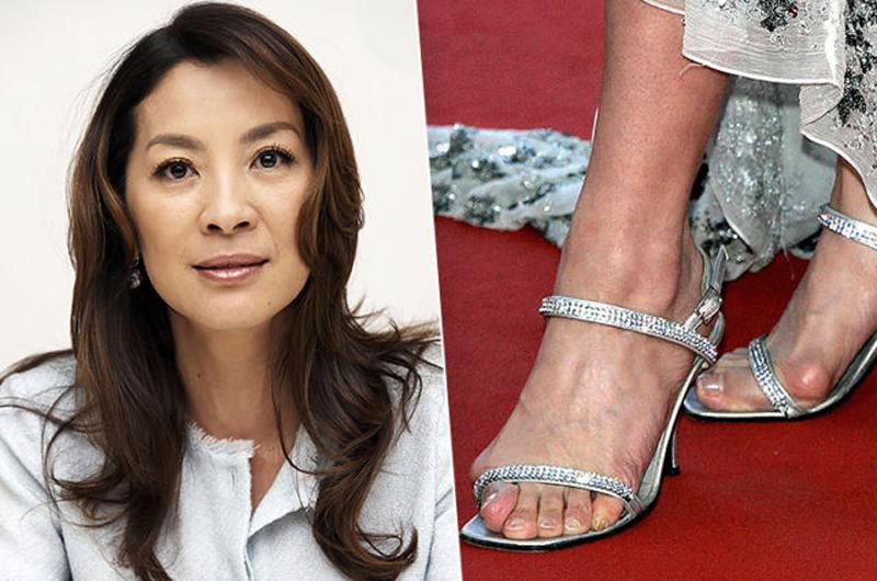 Michelle Yeoh khiến ngón chân cái bị tổn thương khi lạm dụng giày cao gót.
