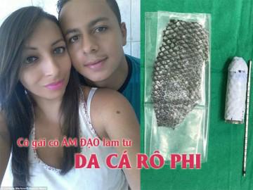 Cô gái có âm đạo làm từ da cá rô phi: Chuyện ấy của tôi giờ rất tuyệt vời