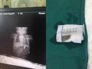 Tin tức - Để con trai 3 tuổi trông hộ con sơ sinh, mẹ hối hận không kịp khi quay trở lại