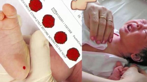 Vì sao lúc mới đẻ, bằng mọi giá mẹ phải lấy 2 giọt máu gót chân trẻ sơ sinh? - 2