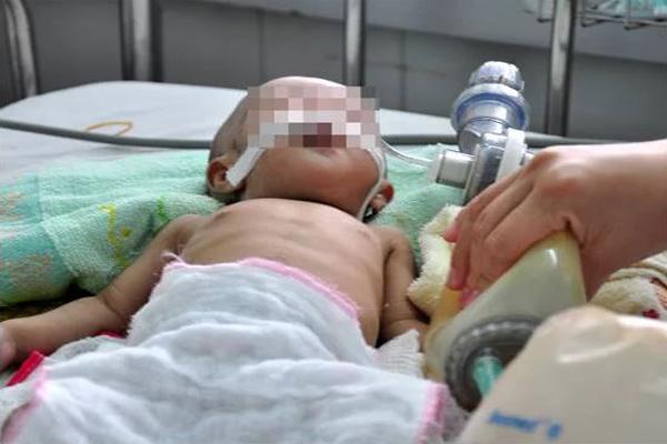 Bé trai nôn ra máu, suýt mất mạng vì ăn lại món ăn nhiều người vẫn hay để qua đêm - 1