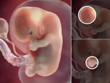 Thai nhi 8 tuần tuổi: Đuôi dần biến mất