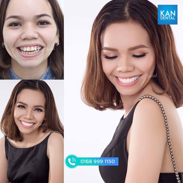 Đan Trường bất ngờ khoe hàm răng trắng sáng bên cạnh chàng nha sĩ điển trai - 5