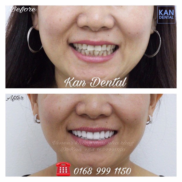 Đan Trường bất ngờ khoe hàm răng trắng sáng bên cạnh chàng nha sĩ điển trai - 6