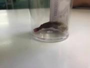 Tin tức - Bé gái 6 tuổi viêm nhiễm âm đạo, tiết dịch hôi thối suốt 2 tháng vì lý do không ngờ